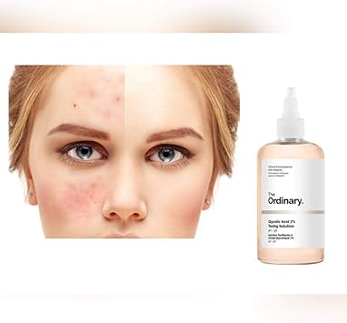 The Ordinary Glycolic Acid 7% Toning Solution - 240 ml